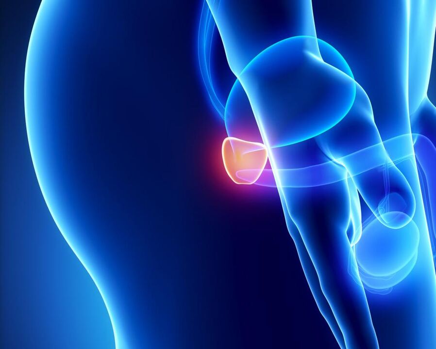 Inflammation of the prostate gland